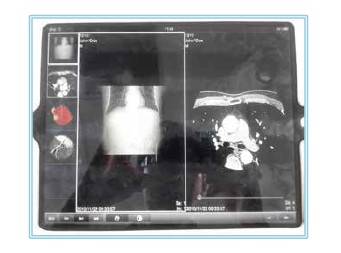 iPad 病人檢查影像呈現